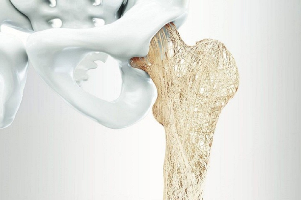 O nouă descoperire în întărirea oaselor poate inversa osteoporoza